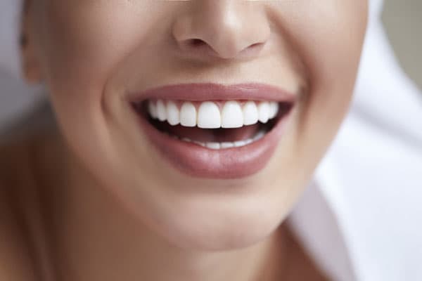 Prótesis dentales fijas