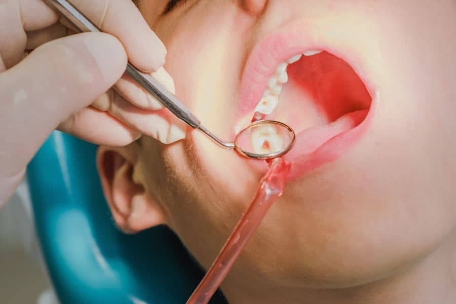 Confía en Sanident para una endodoncia de vanguardia