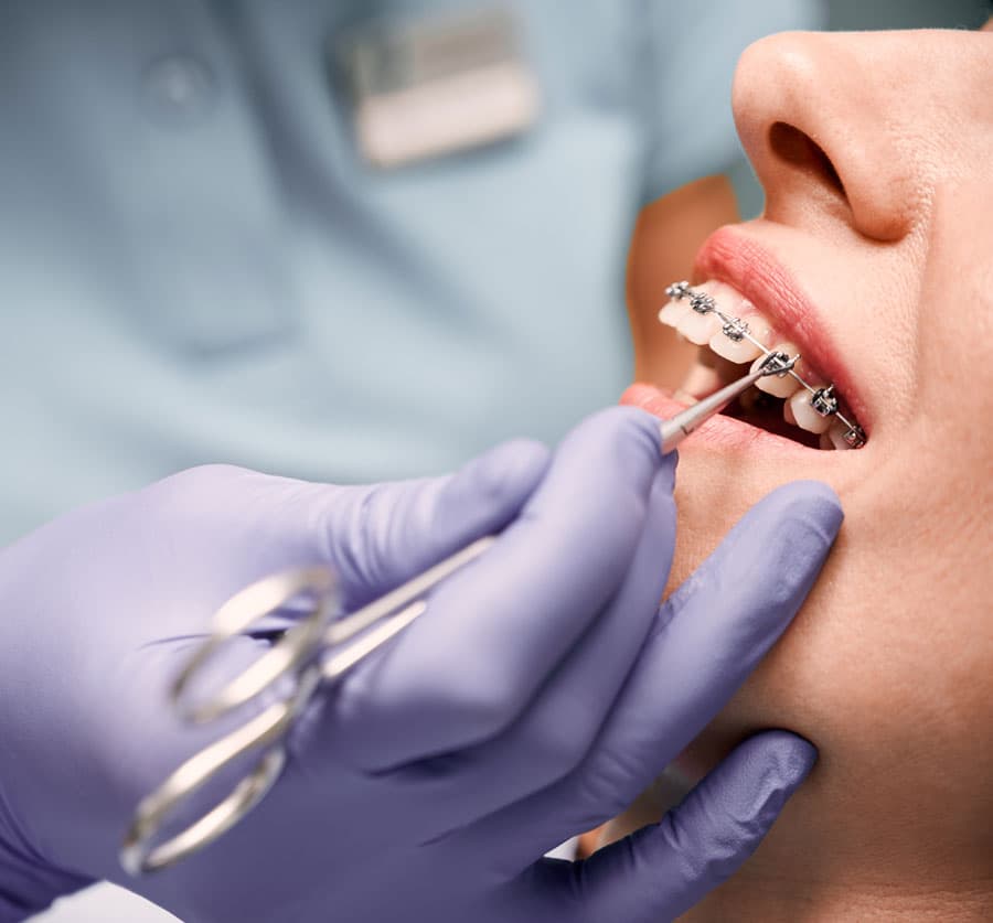 aparato dental en Lugo