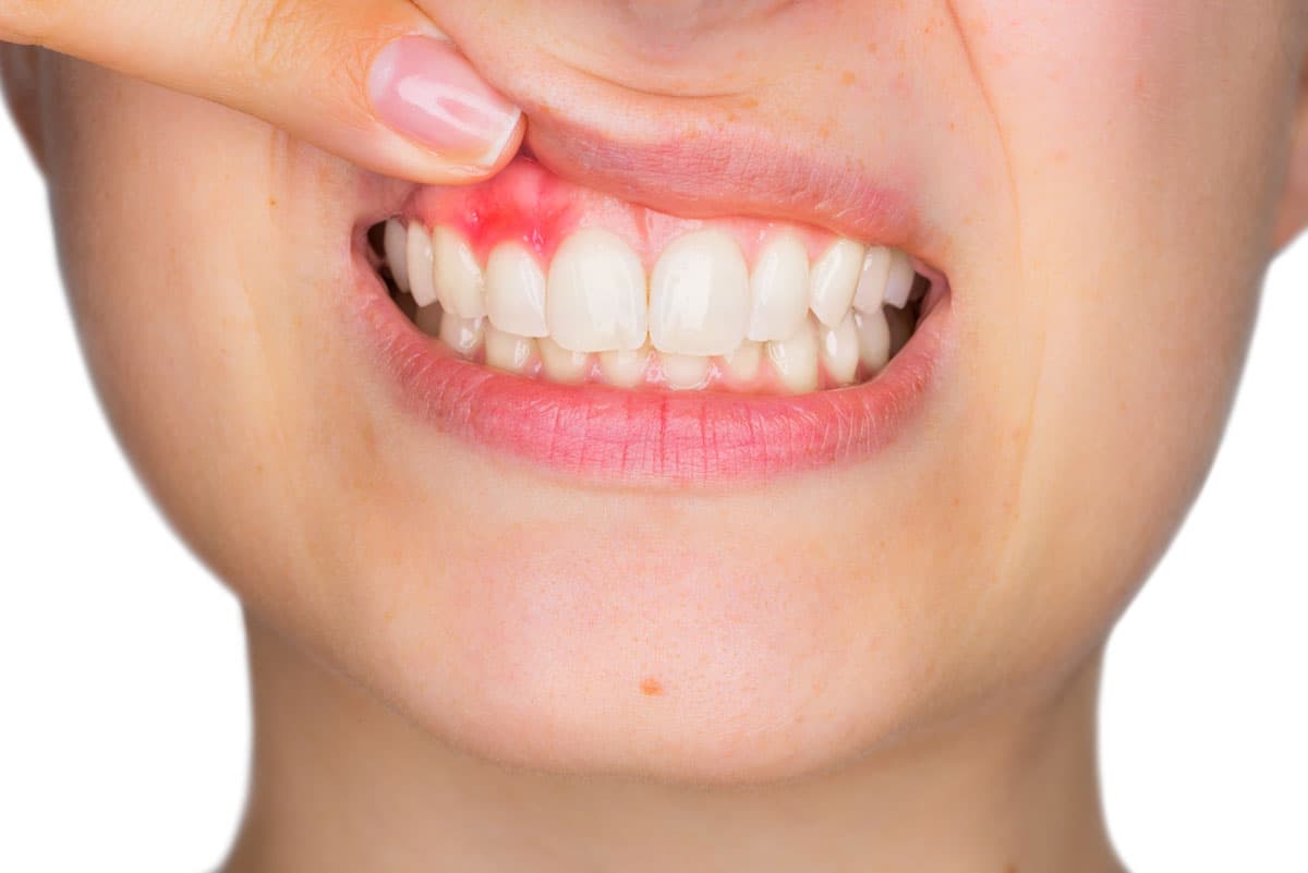 periodoncista en Lugo