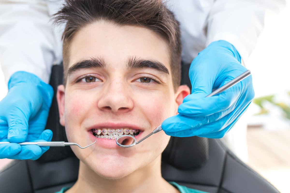 Resuelve tus problemas dentales más comunes con Sanident