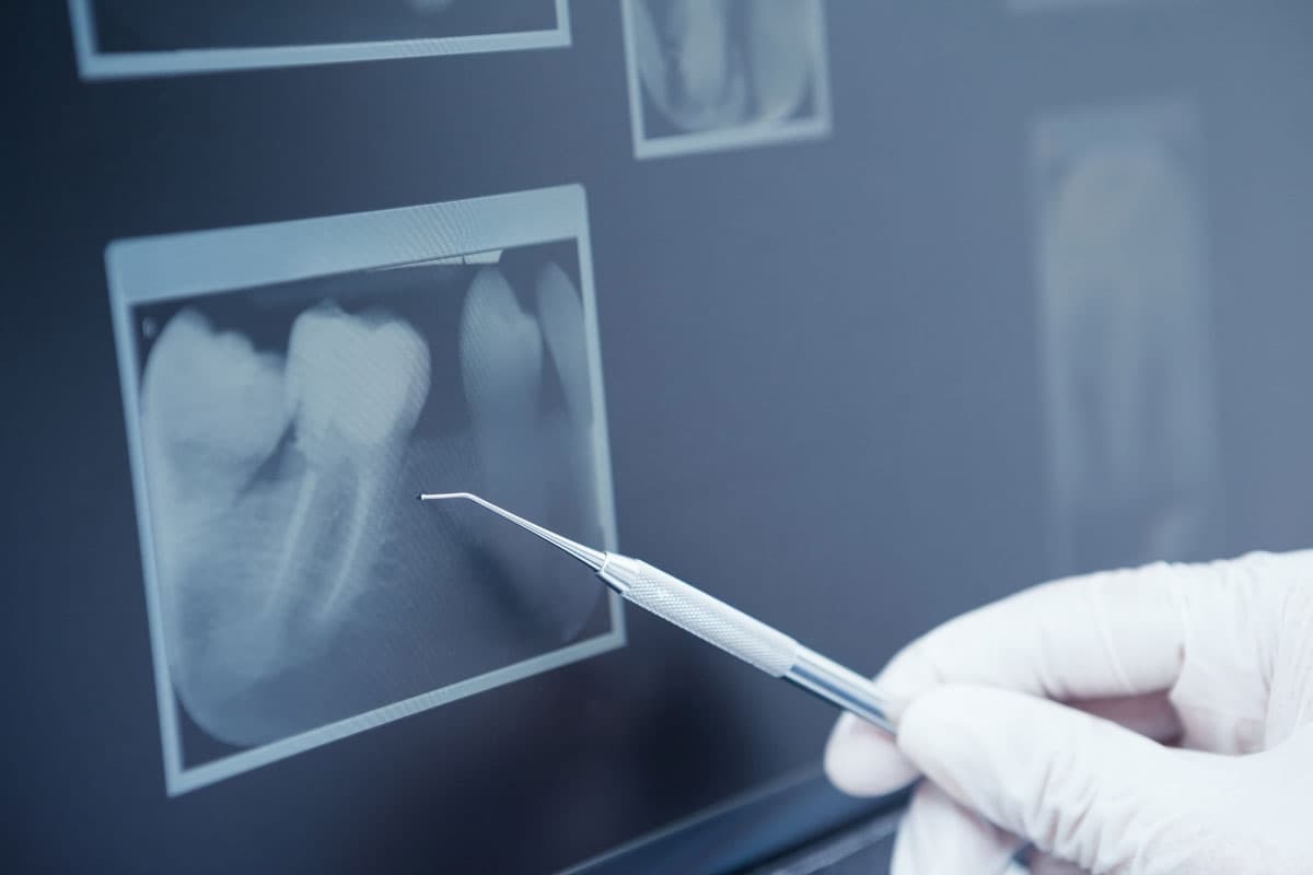 Trabajamos con la última tecnología para el cuidado dental en Lugo